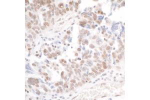 anti-PHD Finger Protein 6 (PHF6) (AA 125-175) antibody