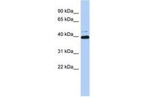 Image no. 1 for anti-MYC-Associated Zinc Finger Protein (Purine-Binding Transcription Factor) (MAZ) (AA 179-228) antibody (ABIN6742437) (MAZ antibody  (AA 179-228))