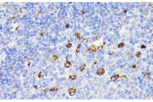 Immunohistochemistry of paraffin-embedded Rat spleen using PSAP Polyclonal Antibody at dilution of 1:200 (40x lens). (Prosaposin antibody)