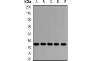 Western blot analysis of PSMD13 expression in HepG2 (A), Jurkat (B), SW620 (C), mouse testis (D), rat lung (E) whole cell lysates. (PSMD13 antibody)