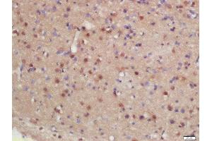 Formalin-fixed and paraffin embedded rat brain labeled with Rabbit Anti-hHR23b Polyclonal Antibody, Unconjugated (ABIN2175752) at 1:200 followed by conjugation to the secondary antibody and DAB staining (RAD23B antibody  (AA 24-120))