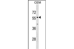 OPTN Antibody (Center) (ABIN1538582 and ABIN2849499) western blot analysis in CEM cell line lysates (35 μg/lane). (OPTN antibody  (AA 71-96))