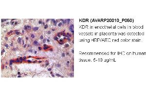 Image no. 1 for anti-VEGF Receptor 2 (VEGFR2) (N-Term) antibody (ABIN2792307) (VEGFR2/CD309 antibody  (N-Term))
