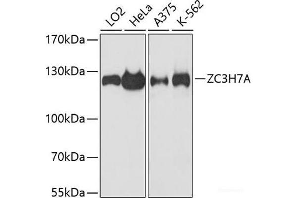 ZC3H7A antibody