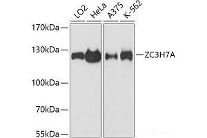 ZC3H7A antibody