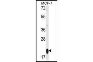 Western blot analysis in MCF-7 cell line lysates (35 ug/lane) using RT25 Antibody (C-term) Cat.