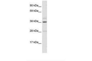 Image no. 1 for anti-Ceramide Synthase 3 (CERS3) (AA 54-103) antibody (ABIN6735903) (LASS3 antibody  (AA 54-103))