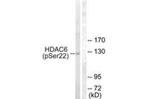 Western blot analysis of extracts from NIH-3T3 cells treated with Anisomycin 25ug/ml 30', using HDAC6 (Phospho-Ser22) Antibody. (HDAC6 antibody  (pSer22))
