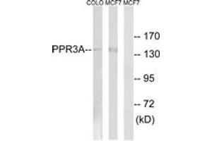 Western blot analysis of extracts from MCF-7/COLO cells, using PPP1R3A Antibody. (PPP1R3A antibody  (AA 647-696))