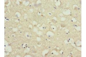 Immunohistochemistry of paraffin-embedded human brain tissue using ABIN7161221 at dilution of 1:100