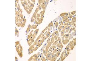 Immunohistochemistry of paraffin-embedded mouse heart using KYNU antibody (ABIN5973997) at dilution of 1/100 (40x lens).