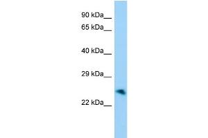 Host:  Rabbit  Target Name:  Unkl  Sample Type:  Mouse Stomach lysates  Antibody Dilution:  1. (UNKL antibody  (Middle Region))