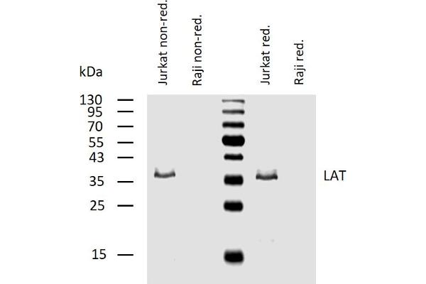 LAT antibody  (Cytoplasmic Domain)