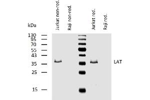 Western blotting analysis of human LAT using mouse monoclonal antibody LAT-01 in lysates of Jurkat cells (positive) and Raji cells (negative control) under non-reducing and reducing conditions. (LAT antibody  (Cytoplasmic Domain))