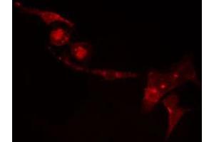 ABIN6274455 staining Hela cells by IF/ICC. (CDKL2 antibody  (Internal Region))