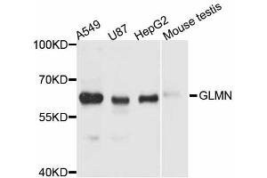 Western blot analysis of extracts of various cell lines, using GLMN antibody (ABIN6291150) at 1:3000 dilution. (GLMN antibody)