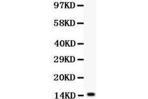 Anti- IL15 antibody, Western blotting All lanes: Anti IL15  at 0. (IL-15 antibody  (AA 49-162))