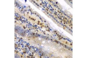 Immunohistochemistry of paraffin-embedded mouse Intestine using SYNCRIP antibody. (SYNCRIP antibody  (AA 1-200))