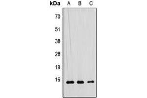 Western blot analysis of RAD52B expression in HEK293T (A), Raw264. (RDM1 antibody  (Center))