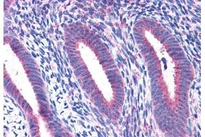 ABIN238580 (3. (RPL22 antibody  (C-Term))
