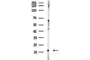 Western blot analysis of lysates from  cells(heat-shock, 45 min treatment), using CNPY2/MSAP Antibody at 1/1000 dilution.