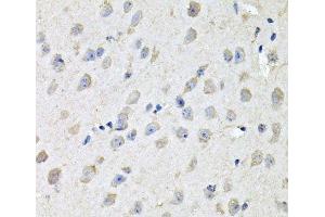 Immunohistochemistry of paraffin-embedded Mouse brain using CHCHD3 Polyclonal Antibody at dilution of 1:100 (40x lens). (CHCHD3 antibody)