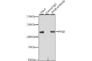 Immunoprecipitation (IP) image for anti-phosphorylase, Glycogen, Brain (GPBB) (AA 544-843) antibody (ABIN6146522)