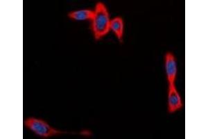 Immunofluorescent analysis of CYB561D1 staining in MCF7 cells. (CYB561D1 antibody  (C-Term))