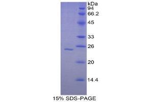 SDS-PAGE (SDS) image for Glutathione Synthetase (GSS) (AA 268-474) protein (His tag) (ABIN2121133)
