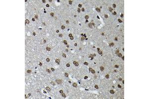Immunohistochemistry of paraffin-embedded rat brain using Cyclin K Rabbit pAb (ABIN6128996, ABIN6138098, ABIN6138099 and ABIN6214445) at dilution of 1:100 (40x lens). (Cyclin K antibody  (AA 1-160))