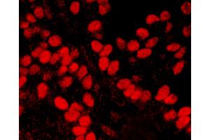 Immunofluorescence (IF) image for anti-High Mobility Group Nucleosome Binding Domain 1 (HMGN1) (AA 90-100) antibody (ABIN7455239)