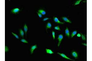 Immunofluorescent analysis of Hela cells using ABIN7166275 at dilution of 1:100 and Alexa Fluor 488-congugated AffiniPure Goat Anti-Rabbit IgG(H+L) (VAC14 antibody  (AA 333-523))