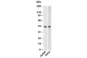 Western blot testing of human samples with beta Actin antibody at 1 ug/ml.