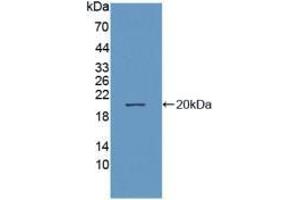 Western blot analysis of recombinant Human NEP. (MME antibody  (AA 382-538))