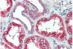 Anti-SLC11A2 antibody  ABIN1049329 IHC staining of human, kidney. (SLC11A2 antibody  (Internal Region))