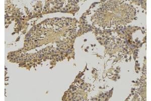 ABIN6276902 at 1/100 staining RAT testis tissue by IHC-P. (HSD3B2 antibody)