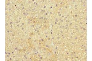 Immunohistochemistry analysis of paraffin-embedded human adrenal gland tissue using IFNLR1 antibody at a dilution of 1/100.