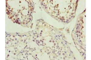 Immunohistochemistry of paraffin-embedded human testis tissue using ABIN7157235 at dilution of 1:100 (KANSL3 antibody  (AA 1-200))