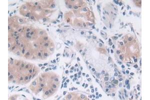 Immunohistochemistry (IHC) image for anti-Sex Determining Region Y (SRY) (AA 1-204) antibody (ABIN7441337)