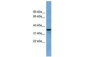 BACE2 antibody used at 1 ug/ml to detect target protein. (BACE2 antibody  (N-Term))