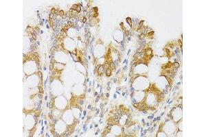 Immunohistochemistry of paraffin-embedded Human rectum using MYO5A Polyclonal Antibody at dilution of 1:100 (40x lens). (MYO5A antibody)