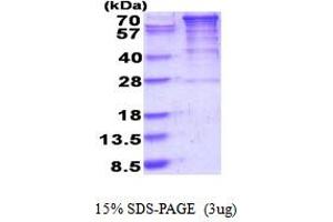 EEF2K Protein (AA 1-725) (His tag)