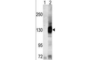 Western blot analysis of CASK (arrow) using Cask Antibody (C-term) .