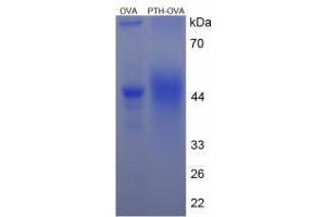 Image no. 2 for Parathyroid Hormone (PTH) peptide (Ovalbumin) (ABIN5666323) (Parathyroid Hormone (PTH) peptide (Ovalbumin))