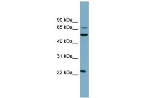 WB Suggested Anti-CLEC6A Antibody Titration:  0. (C-Type Lectin Domain Family 6, Member A (CLEC6A) (N-Term) antibody)