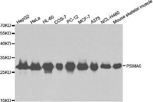 Western blot analysis of extracts of various cell lines, using PSMA6 antibody (ABIN5971214) at 1/1000 dilution. (PSMA6 antibody)