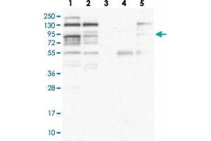 Western blot analysis of Lane 1: RT-4, Lane 2: U-251 MG, Lane 3: Human Plasma, Lane 4: Liver, Lane 5: Tonsil with ZNF227 polyclonal antibody  at 1:100-1:250 dilution. (ZNF227 antibody)