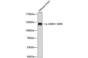 Western blot analysis of extracts from Mouse Brain tissue using Phospho-GRIN1(S896) Polyclonal Antibody. (GRIN1/NMDAR1 antibody  (pSer896))