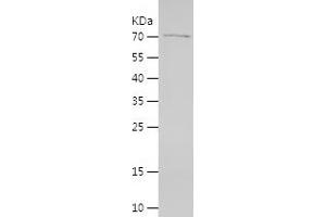 Western Blotting (WB) image for Isthmin 1 (ISM1) (AA 30-464) protein (His-IF2DI Tag) (ABIN7123642) (ISM1 Protein (AA 30-464) (His-IF2DI Tag))