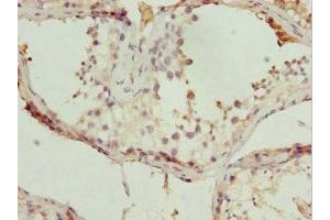 Immunohistochemistry of paraffin-embedded human testis tissue using ABIN7171567 at dilution of 1:100 (TBPL1 antibody  (AA 1-186))